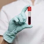 nurse-holding-blood-test-tube-min
