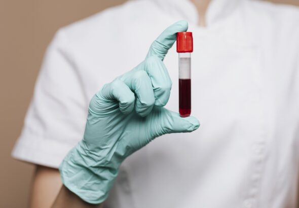nurse-holding-blood-test-tube-min