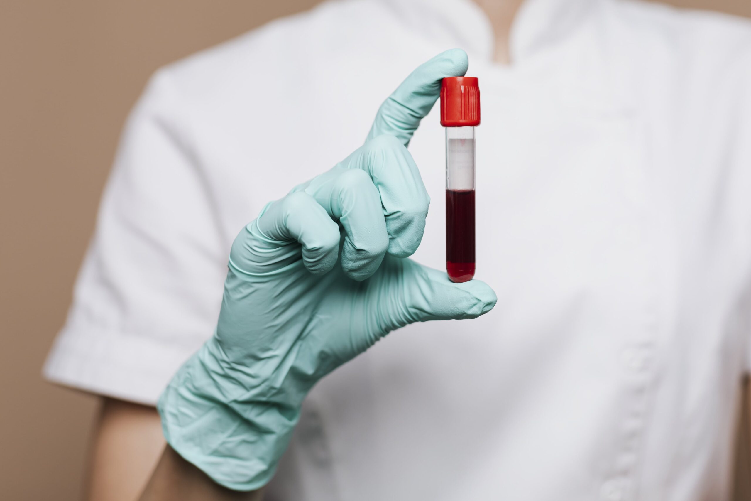 nurse-holding-blood-test-tube-min